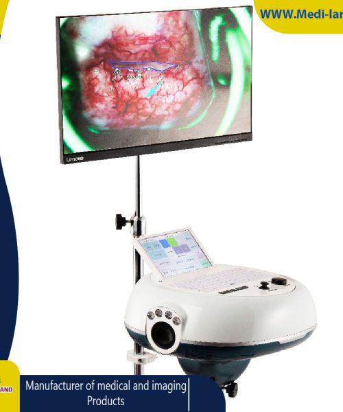 Video Colposcope Device